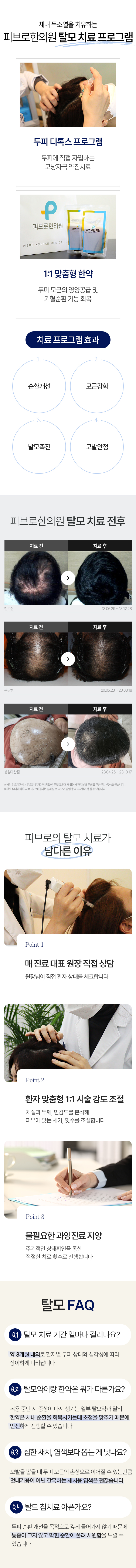 탈모치료