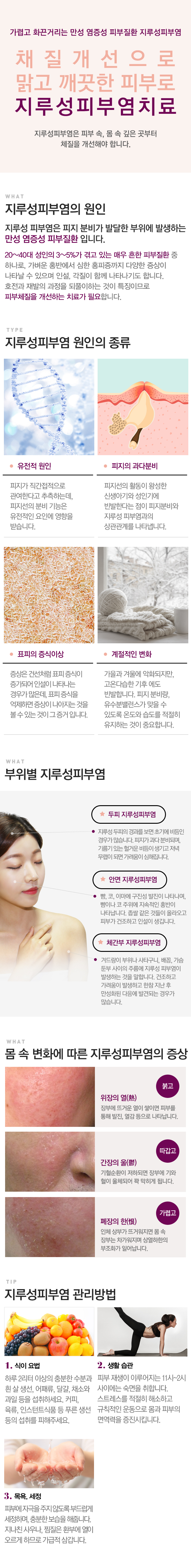 지루성피부염 원인