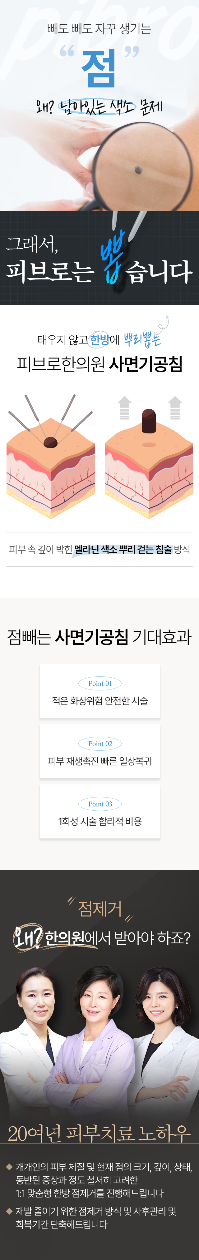 점빼기